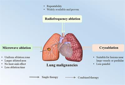 Image-guided percutaneous ablation for lung malignancies